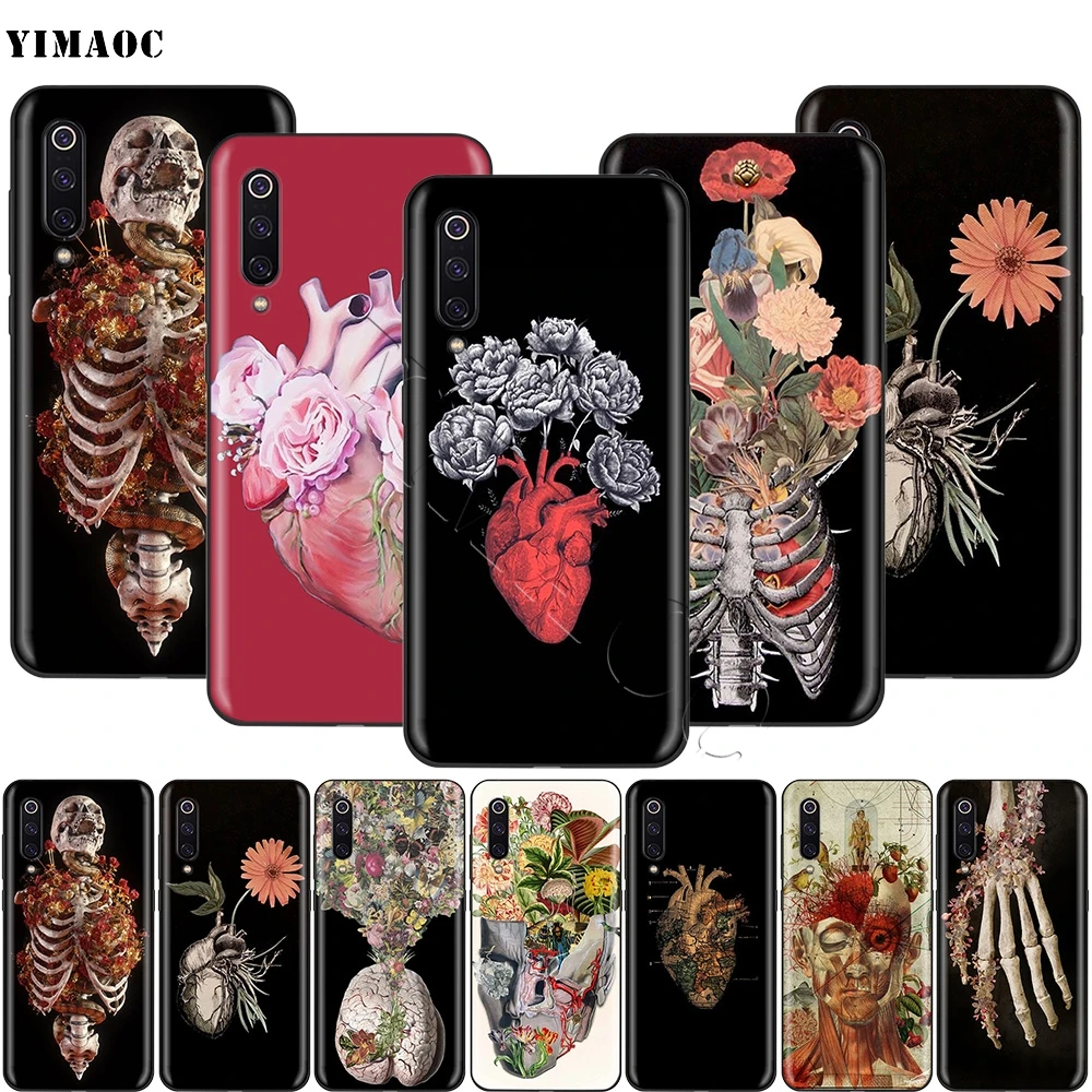 

YIMAOC Medical Human Organs Brain Meridian Kidney Case for Xiaomi Redmi mi Note 3 6a 7 6 8 9 se mi6 mi8 a1 a2 Lite pocophone f1