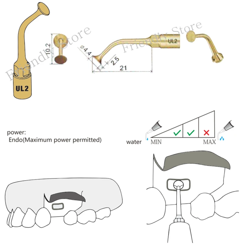 Стоматологический материал 1 шт. UL2 Dentes Стоматологическая насадка для операций для MECTRON и Дятел Пьезо Хирургии для пилинга Mucosa