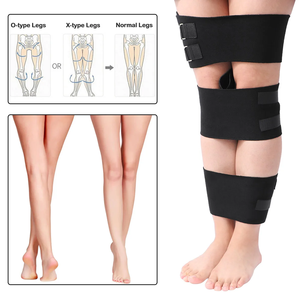 Корректор осанки 3 шт./компл. O/X Legs корректирующие скобки бандаж для ног