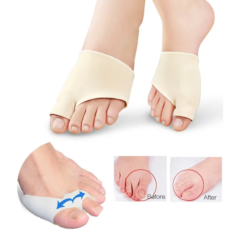 2pair Hallux Valgus Correction of the Thumb Straightener Toes Separator Silicone Foot Care Pads Bunion Corrector Pedicure Tools | Красота и