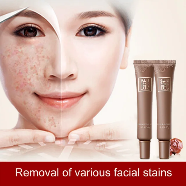 2018 Best Selling Products 30g Skin Care Age Spot Melasma Remove Freckle Face Cream Whitening
