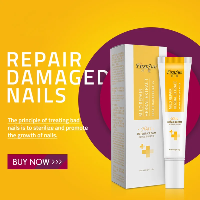 Natural Plant Antibacterial Nail Treatment Cream Nails Fungus Repair Toe Nail Care Cream Effective Onychomycosis Treatment Cream