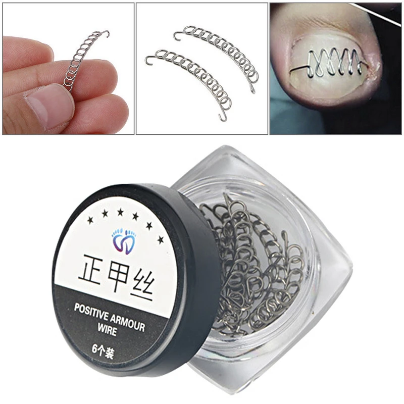 

6pcs/box Silver Ingrown Stainless Steel Toe Nail Correction Wire Fixer Paronychia Recover Tool
