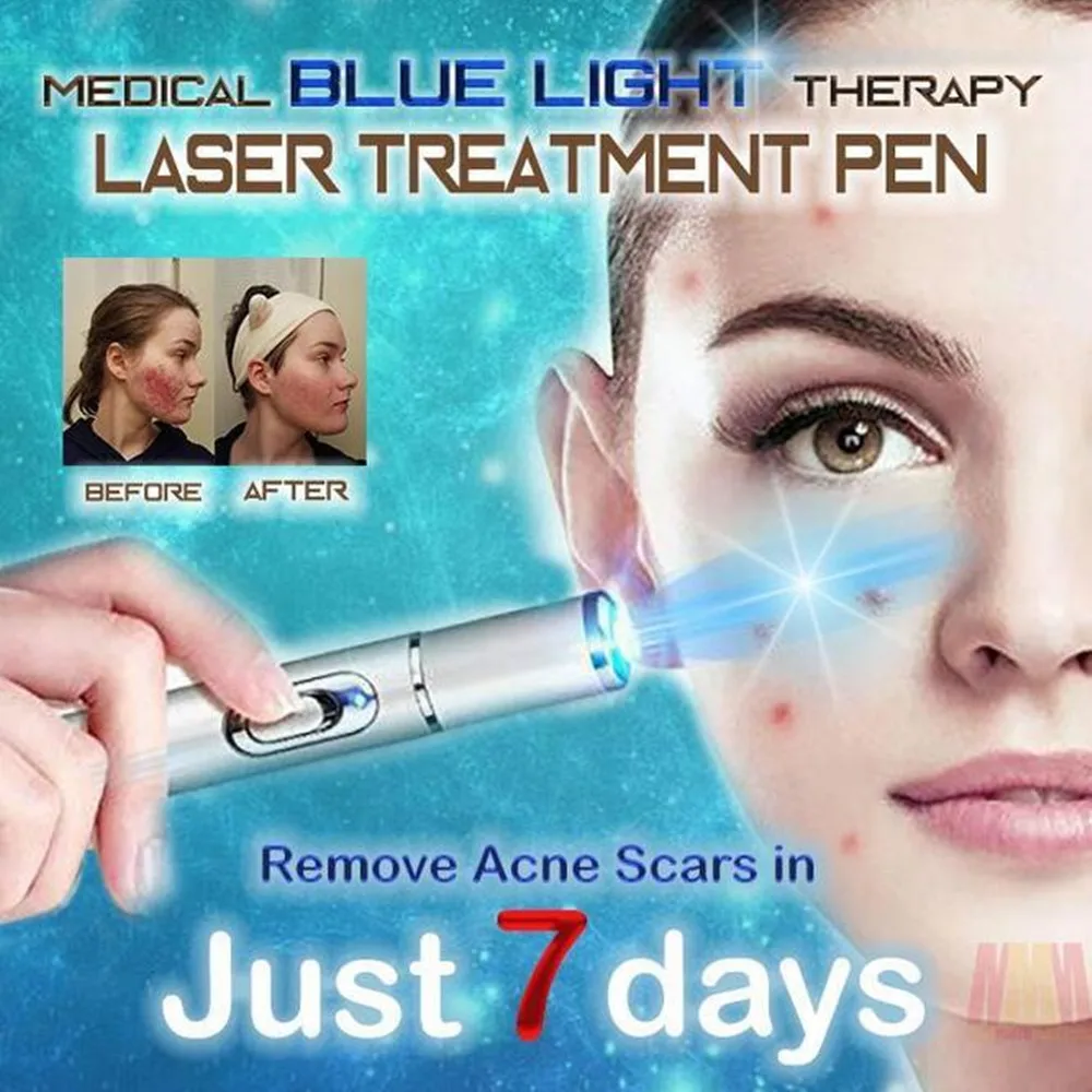 2018 New Medical Blue Light Therapy Laser Treatment Pen Soft Scar