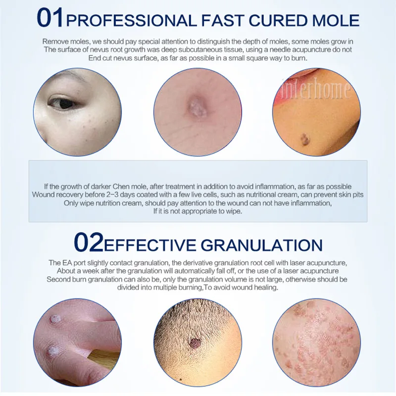 Лазерный бородавки Средства удаления кожи веснушки татуировки пятновыводитель кожи теги машины ухода лазерной плазмы ручка кожи лица