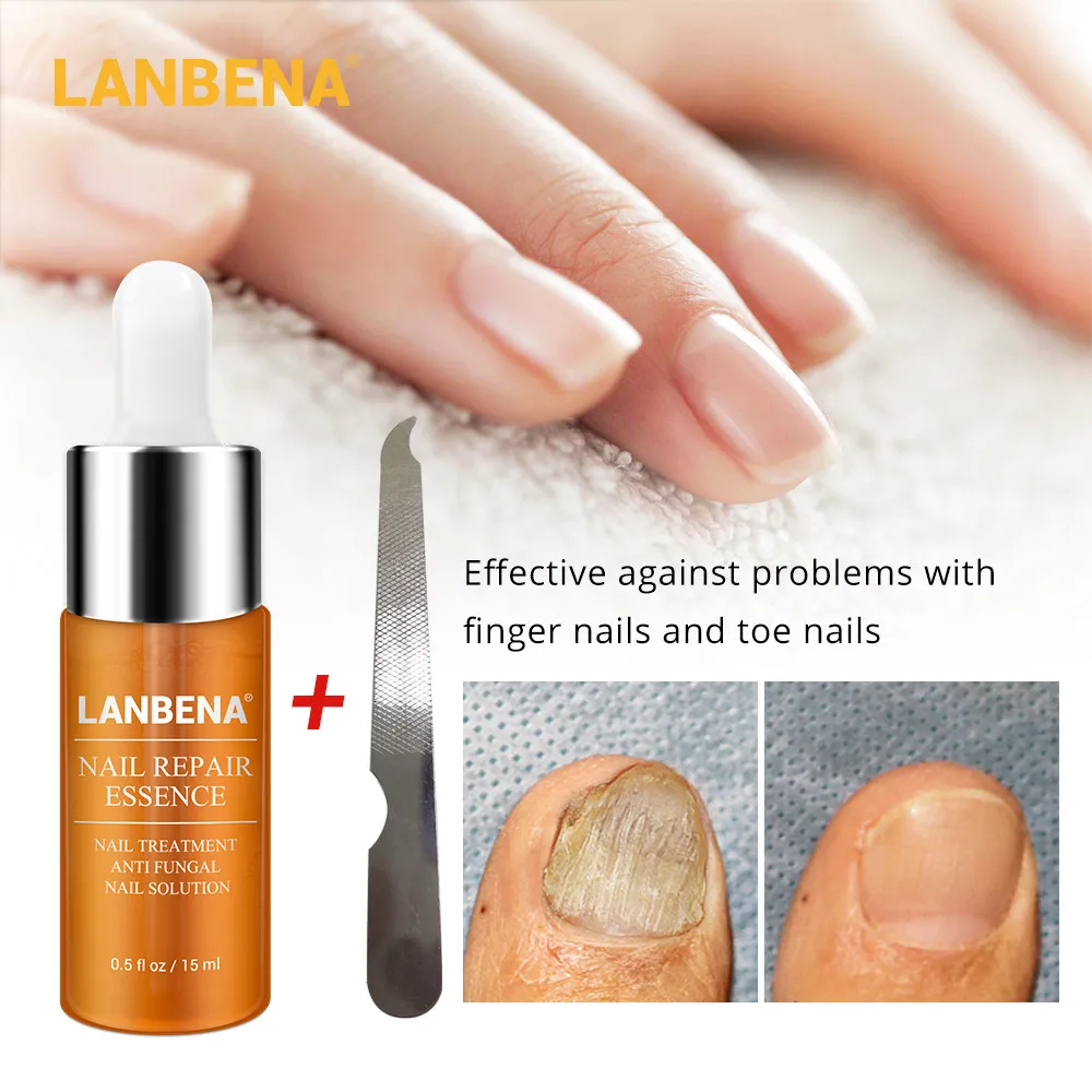 

100% Brand New 15ML Nail Treatment Repair Essence Foot Whitening Softening Nourish Toe Nail File Fungus Removal Nail Solution