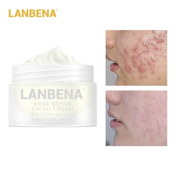 

LANBENA Skin Repair Whitening Snail Cream Facial Cream Anti Wrinkle Anti Aging Acne Treatment Moisturizing Firming Skin Care 30g