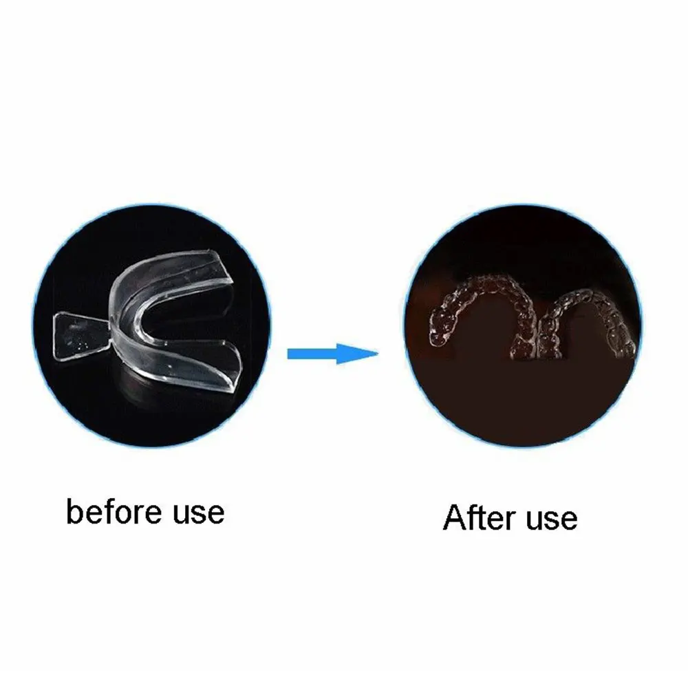 Beli Genkent 2 Pasang Thermoforming Gigi Mouthguard Gigi Whitening Nampan Pemutihan Gigi Pemutih Penjaga Mulut Perawatan Kebersihan Mulut Beli Genkent 2 Pasang Thermoforming Gigi Mouthguard Gigi Whitening Nampan Pemutihan Gigi Pemutih Penjaga Mulut Perawatan Kebersihan Mulut