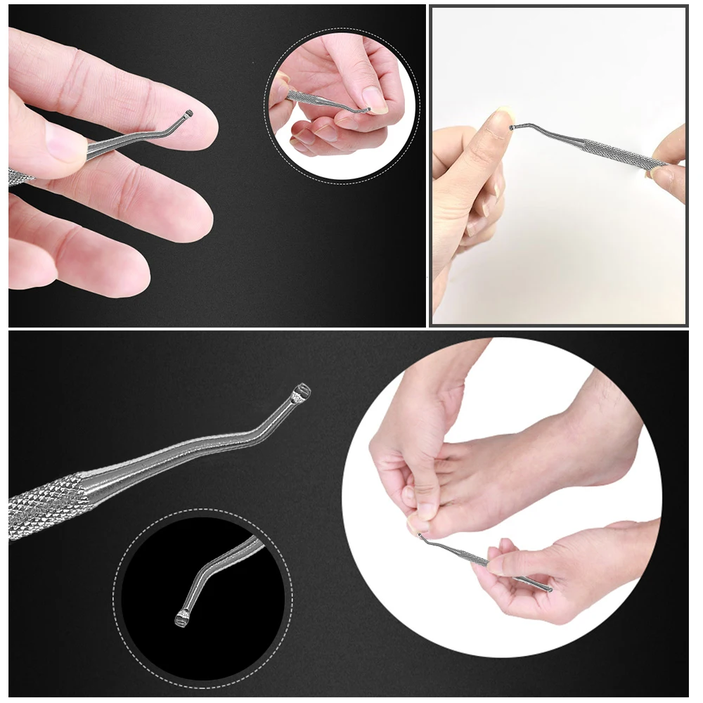 17 Pcs Toenail Ingrown Correction Tool Toe Nail Lifter Nail Glue Toenail Straightening Patch Pusher Recover Pedicure Foot Care
