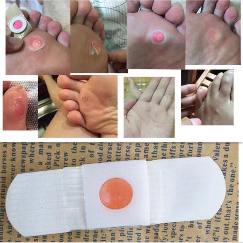 The New 5 PCS Corn Removal Plaster Painless Rapid Eliminate Of Corns