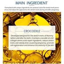 Крем для восстановления растяжек Послеродовое восстановление шрамов и линий ожирения уход за кожей NShopping