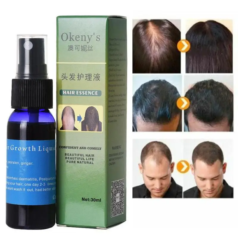 

30ml Ginger Growth Oil Fast Growth Hair Essence Anti-hair Loss Oil Nutrition Restore The Vitality Of Hair Root For Hair Care