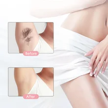 Эпилятор совершенное средство для удаления волос мини электрический прибор для удаления волос для лица депилятор Defeatherer модный абсорбция для тела лица шеи