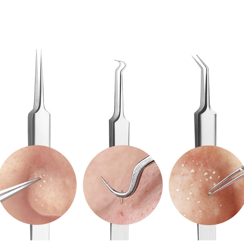 Dropshipping Newest 1Pc Acne And Black Head Tweezers Acne Clip Bend