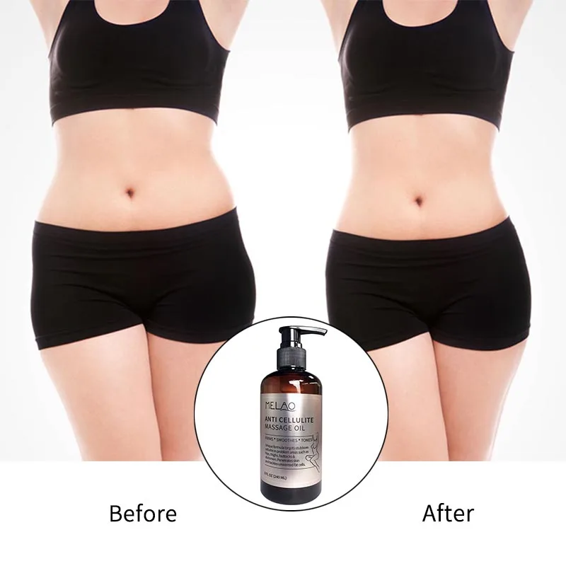 MELAO Anti Cellulite Treatment Massage Oil All Natural Ingredients Target Unwanted Fat Tissues Improves Skin Firmness 8 OZ 240ml | Красота и