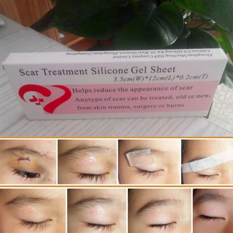 1PCwithBoxpackSiliconeScarRemovalPatchtoRemoveScarTrauma