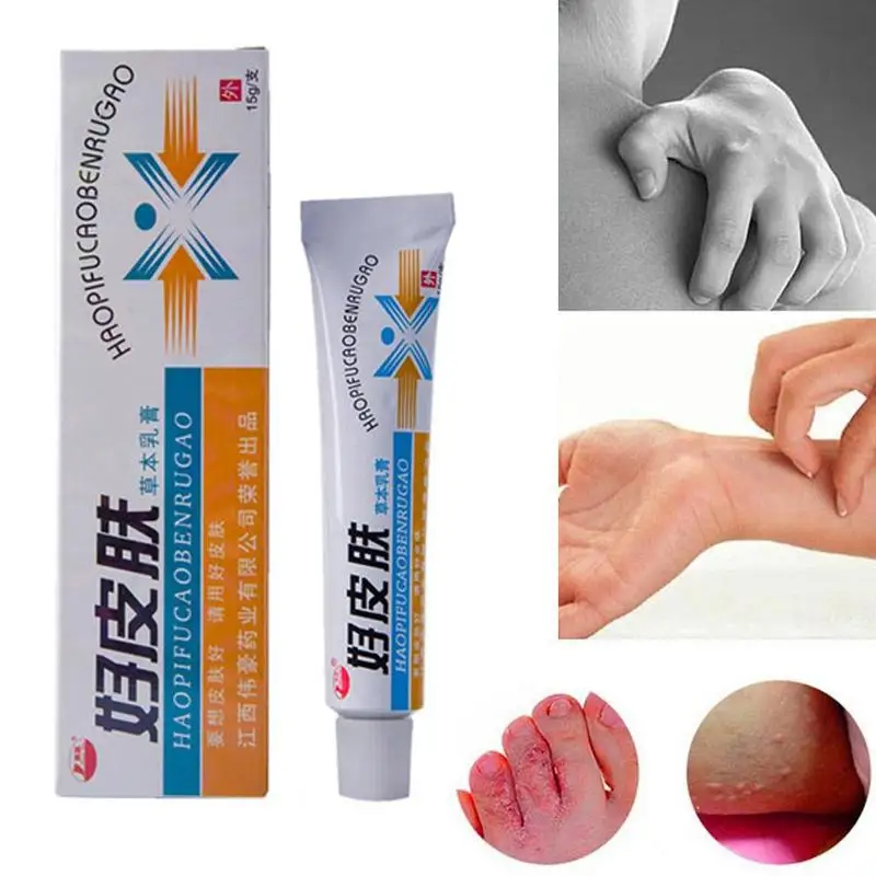 1PCS Skin Psoriasis Cream Dermatitis Eczematoid Eczema Ointment Treatment Psoriasis Cream Skin Care Body Cream Dropshipping