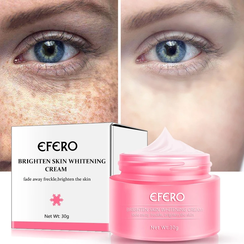 30g Effective Remove Freckles Cream Skin Whitening Cream Reduces Age Spots Fade Dark Spots Treatment Stain Face Cream Aliexpress