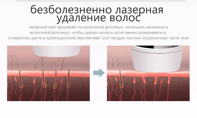 Kemei6812 Фотон лазерной Для тела удаления волос постоянным безболезненно леди Эпиляторы 100-240 В