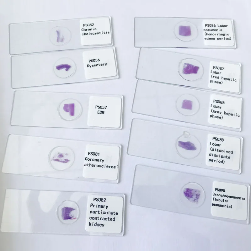 Prepared Human Histopathology Inflammation Microscope Slides Set For Biology Science Education Pack Of 2pcs Specimen By Diy Science Microscope Sample Slides Industrial Scientific Prepared Human Histopathology Inflammation Microscope Slides Set For Biology Science Education Pack Of 2pcs Specimen By Diy Science Microscope Sample Slides Industrial Scientific