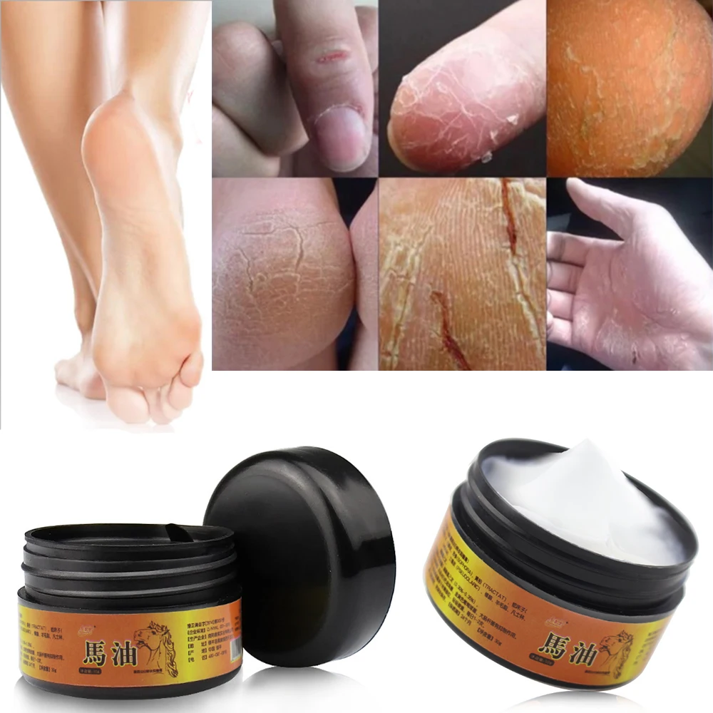 

30g Horse Oil Foot Hand Antifreeze Cream Treatment Dry Skin Heel Chapped Peeling Repair Anti Chapping Wrinkle Treatment D323