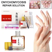 Набор для лечения грибка для ногтей Onychomycosis удаление противогрибковый Toenail Уход за ногтями восстанавливающая жидкость 25 мл KG66