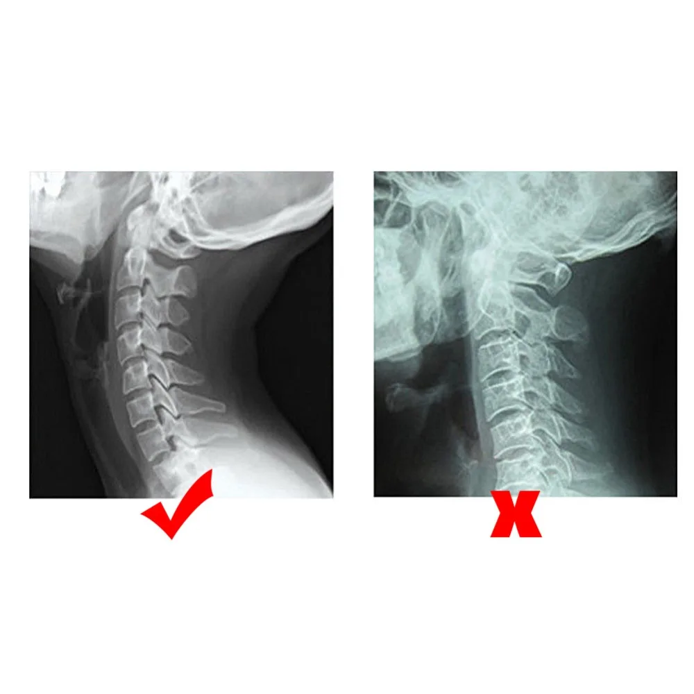 Регулируемый шейный фиксатор для фиксации шеи коррекция шеи носилки бытовые Двери свисающие от боли в шее