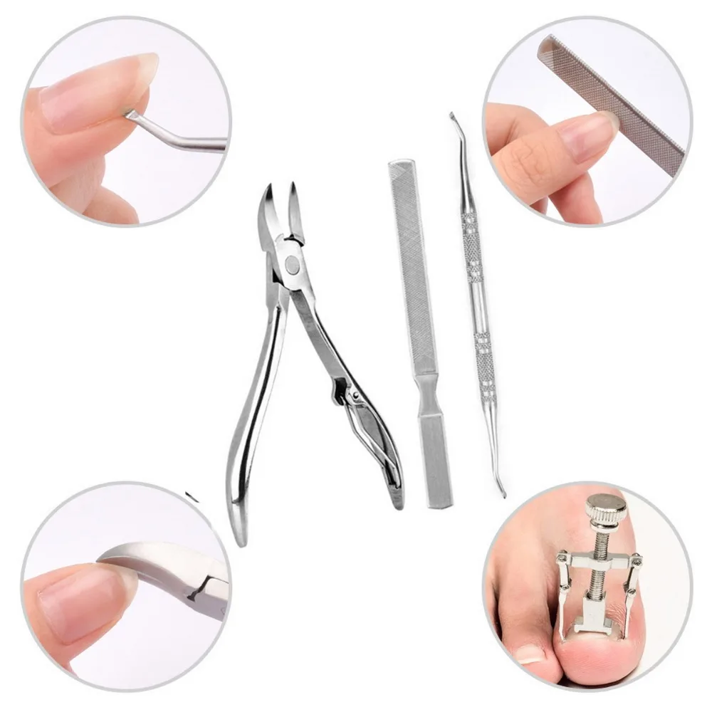 скальпель для ногтей. инструмент для педикюра вросший ноготь. инструмент для педикюра вросший ноготь кюретка. инструмент для коррекции вросшего ногтя. фиксатор для вросшего ногтя.