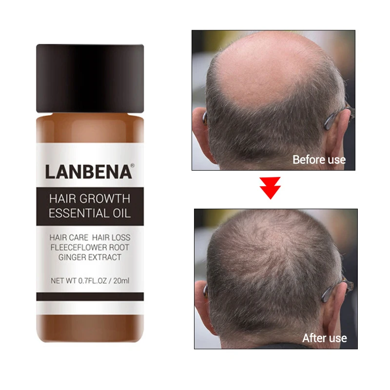 Lanbena Fast Sunburst Hair Growth Essence Products Dense Hair