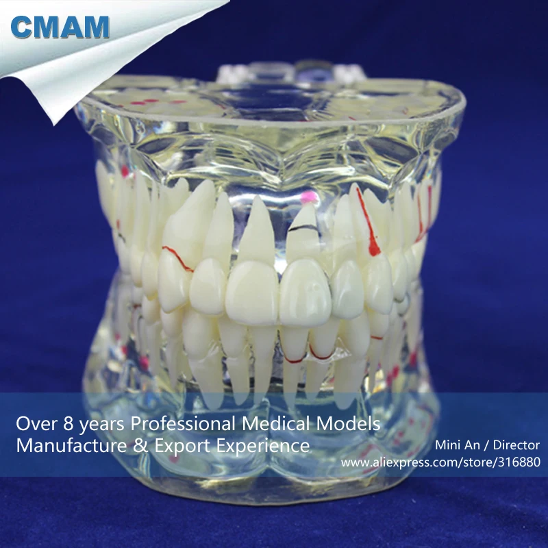 

CMAM/12568 Dental- Pathological dental model, demo, Human Oral Dental Medical Teaching Anatomical Model