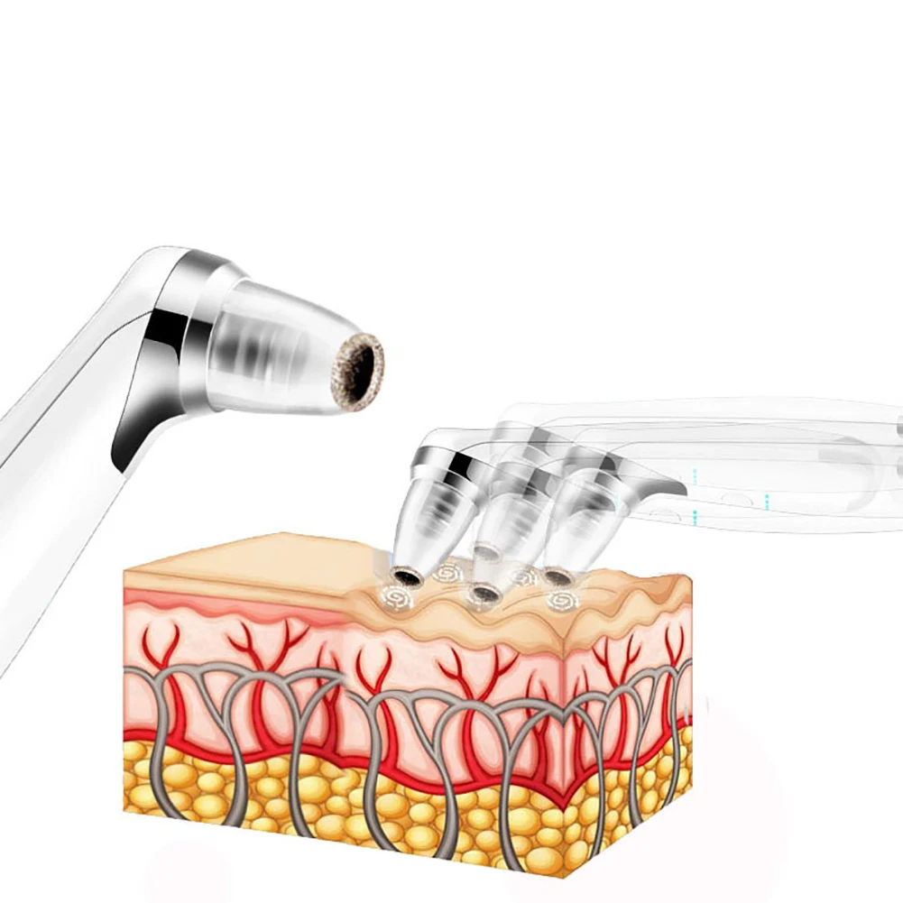 Многофункциональный инструмент для удаления угрей три-Цвет омоложения кожи масло для лица для удаления угрей, Чистка Пор, выделяет морщин Укрепляющий кожи