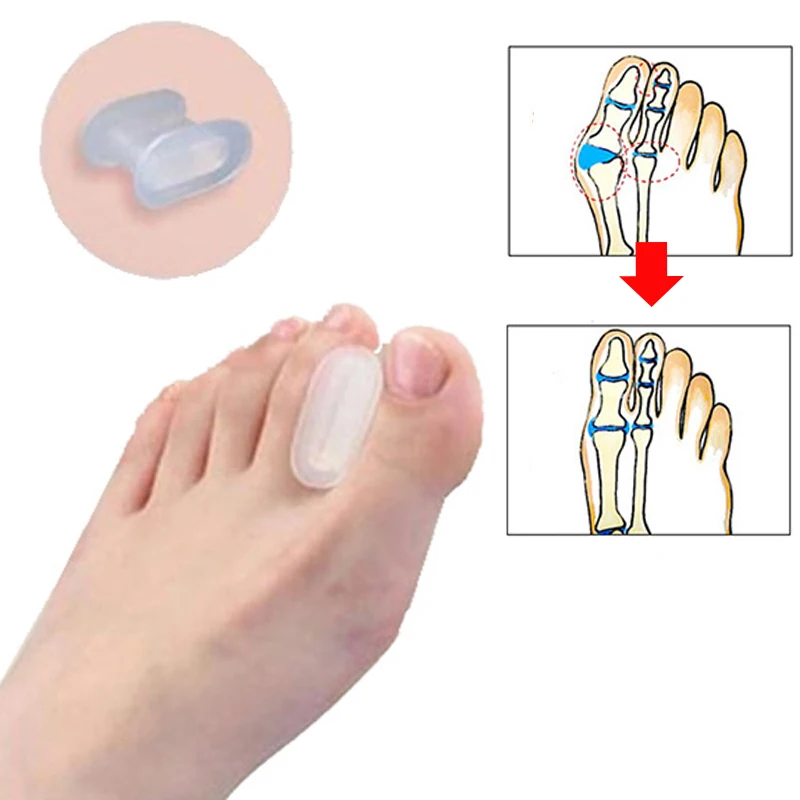 1 пара костного большого пальца вальгусный протектор Силиконовый сепаратор для пальцев ноги регулятор вальгусной деформации корректор для педикюра Уход за ногами