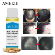AIMEIZII Hair Care Hair Growth Oils Essence Hair Loss Products Natural Essential Oils Dense Hair Growth Serum Health Care Beauty AIMEIZII Hair Care Hair Growth Oils Essence Hair Loss Products Natural Essential Oils Dense Hair Growth Serum Health Care Beauty