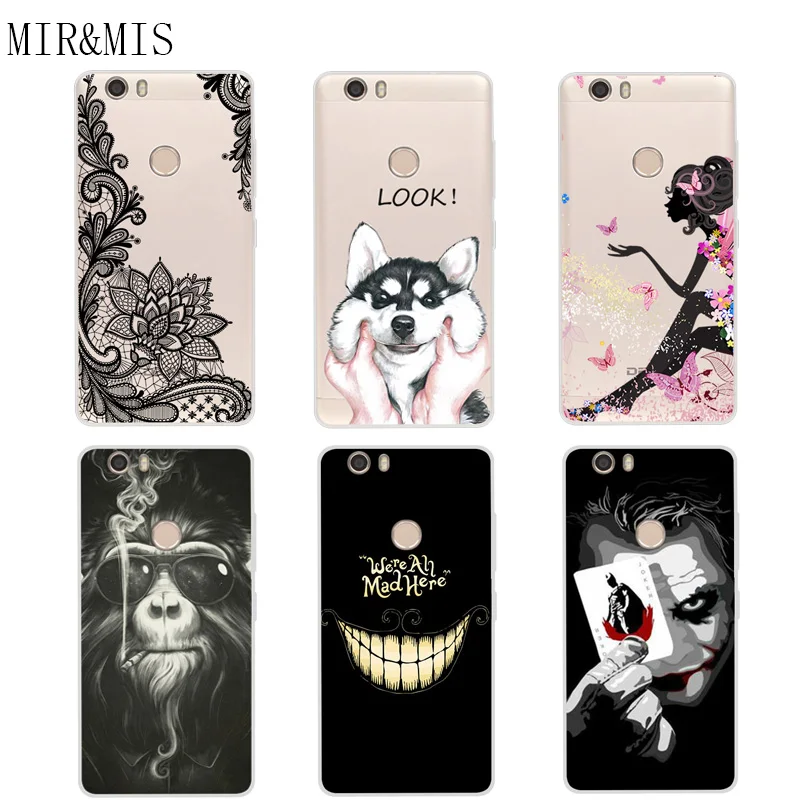Case For Dexp Ixion X150 5.0inch Transparent Printing Drawing Silicone Phone Cases Cover 5.0 Inch |