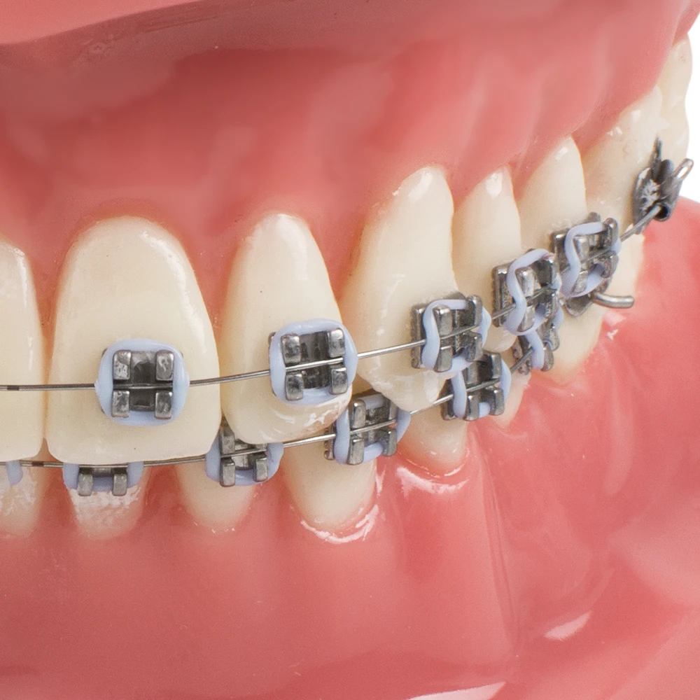 Стоматологическая обследование зубов Ортодонтическая щеточка Красный модель с металлической и керамические кронштейны полости рта демонстрация модели