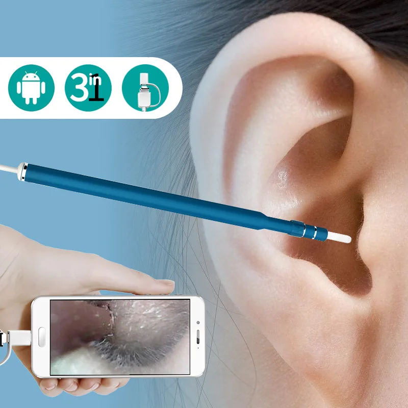 TRINIDADWOLF 2018 Newest HD visual ear cleaning tool Mini Camera otoscope Ear Health Care USB Ear Cleaning Endoscope for android
