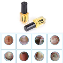 1 шт 5 мл Лечение ногтей Onychomycosis Paronychia против грибковой инфекции ногтей хороший результат Китайский Травяной Уход за ногтями