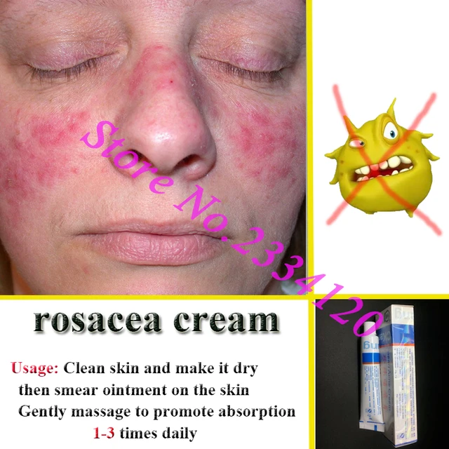 الجديد في علاج الوردية Rosacea