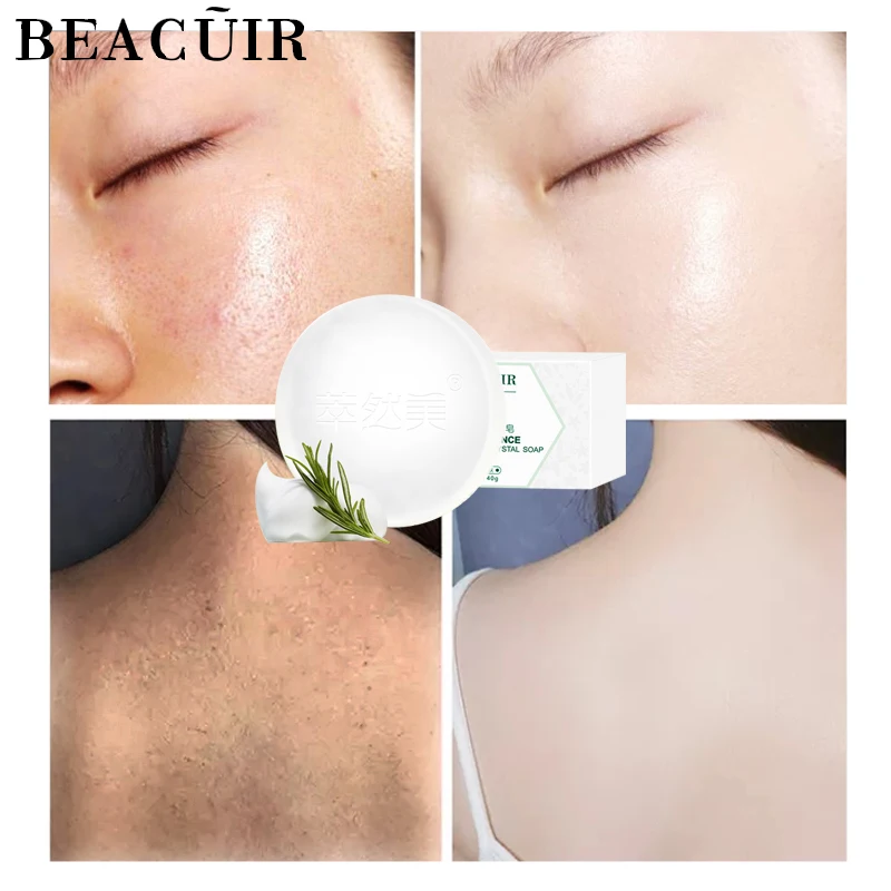 

BEACUIR Vitamin Acne Facial Soap Removal Pimple Pores Cleaner Moisturizing Tender Slippery Tight Face Skin Care Wash Basis Soap