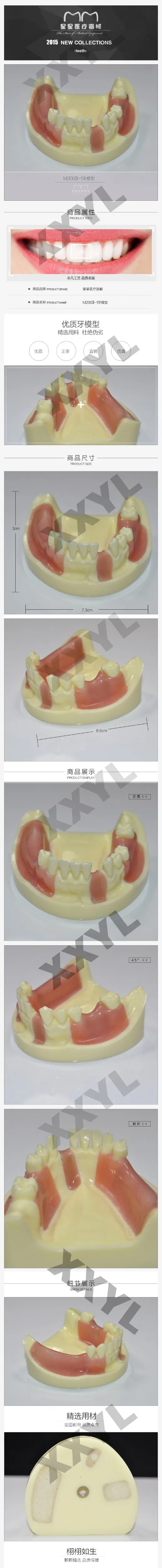 Falta de Simulação do Modelo de Implantes Dentários Dentes Perdidos Frete Grátis 3 dentários dentes Perdidos frete grátis