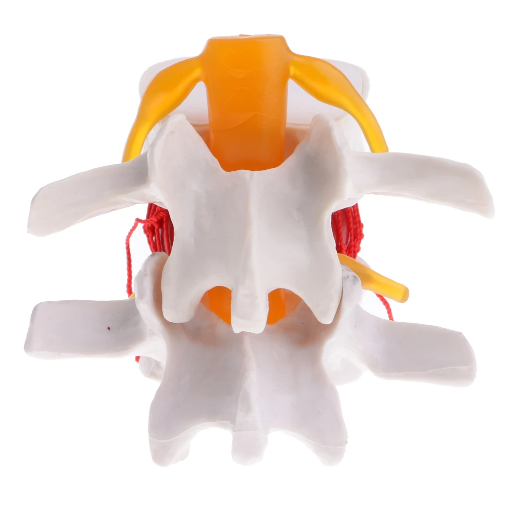  Anatomical Human Lumbar Vertebrae Degenerative Disc Model  Lab Demonstration Supplies  Medical Teac - 33036948097