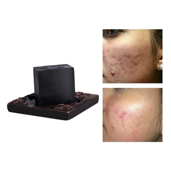 

1PCS Bathing Soap Shower Bamboo Charcoal Handmade Soap Body Skin Whitening Soap For Private Parts Fade Areola Scar Repair