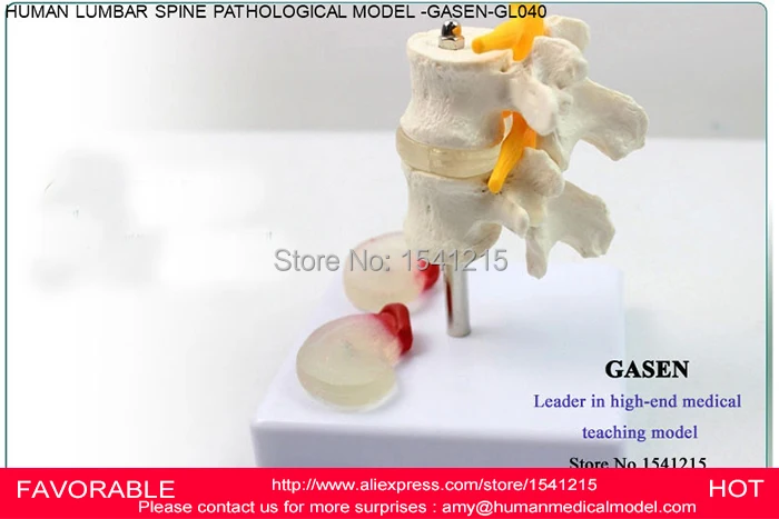 

LUMBAR MODEL SPINAL NERVE MODEL CAUDAL EQUINA NERVE LUMBAR SPINE DISC MODEL SPINE CHIROPRACTIC SKELETON MODEL-GASEN-GL040