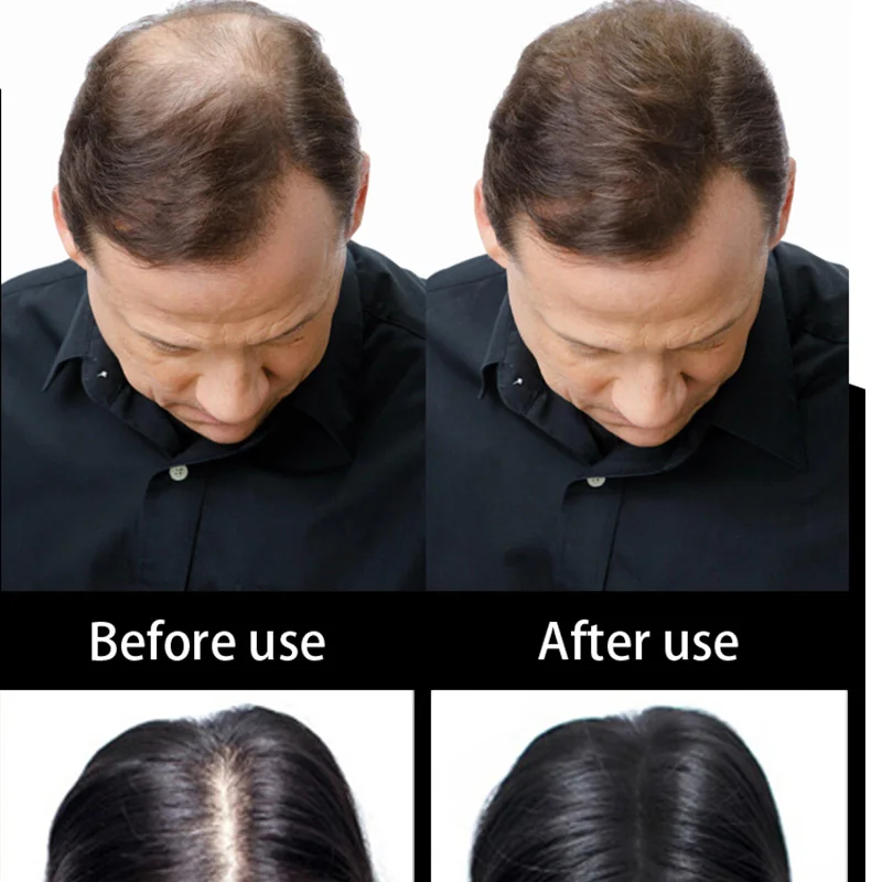 10colors Spray Thicker Concealer Thin Hair Loss Treatment Care Male/Female Keratin Hair Fibers Powder Brand Toppik 25g Natural 10colors Spray Thicker Concealer Thin Hair Loss Treatment Care Male/Female Keratin Hair Fibers Powder Brand Toppik 25g Natural