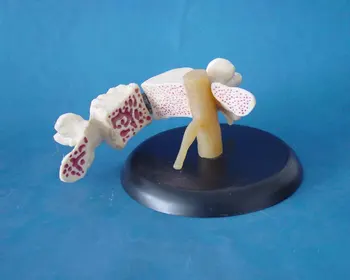 

Life Size Osteoporosis Heath and Morbid State Bone Compare Models Human Spinal Bone Human Spine Pathology Model Humans Skeleton