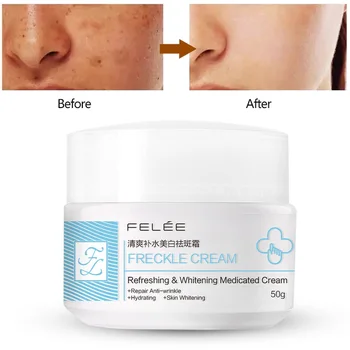 

New Freckle Removal Cream Moisturizing Lighten Melanin Brighten Skin Color Freckle Cream