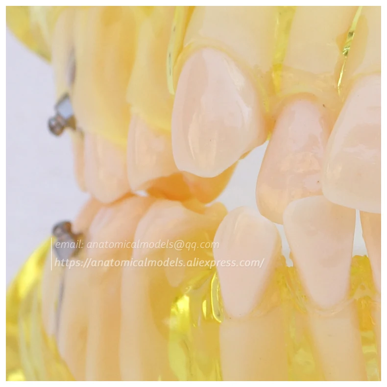 13022 DH202 Orthodontic Model , cmam anatomical model 