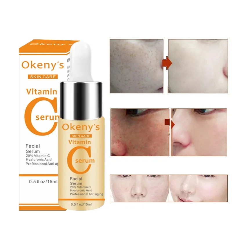 

Vitamin C Serum VC Removing Dark Spots Freckle Speckle Fade Ageless Skin Care Whitening Face Anti Winkles Essence Beauty