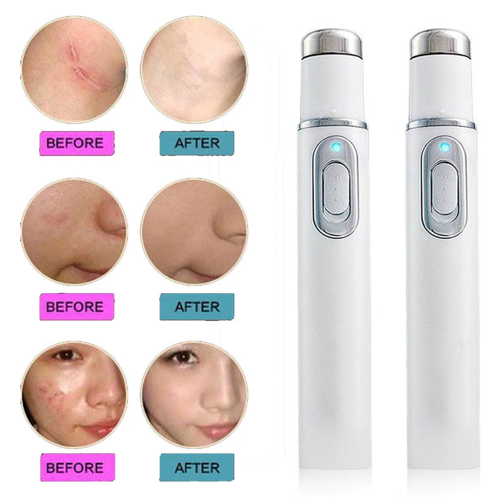

Fast Delivery ! Medical Blue Light Gentle Therapy Skin Care Laser Treatment Pen Scar Acne Wrinkle Removal Beauty Device