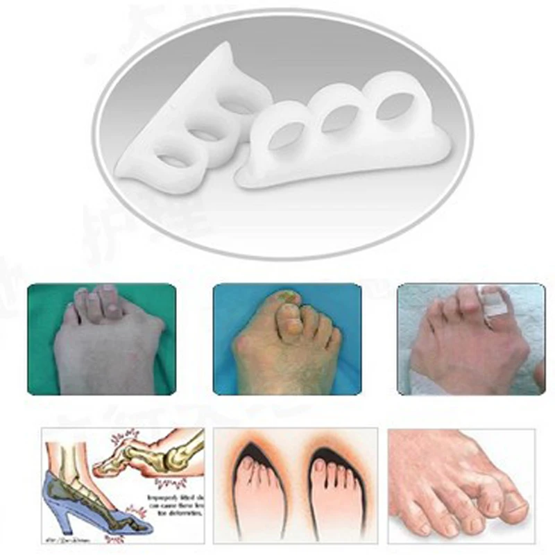 1 пара = 2 шт силиконовый корректор для маникюра разделитель для пальцев ног инструмент для ухода за ногами разделитель для пальцев ног Коррекция большого пальца ноги